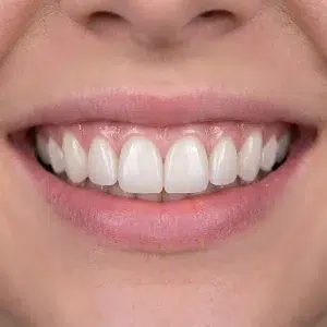 لمینیت دیجیتال کلینیک دندانپزشکی شادان