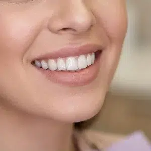 لمینیت دیجیتال کلینیک دندانپزشکی شادان