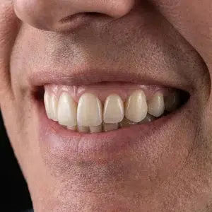 لمینیت دیجیتال کلینیک دندانپزشکی شادان