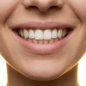 لمینیت دیجیتال کلینیک دندانپزشکی شادان