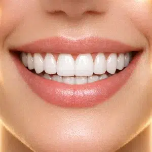 لمینیت دیجیتال کلینیک دندانپزشکی شادان