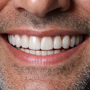 لمینیت دیجیتال کلینیک دندانپزشکی شادان