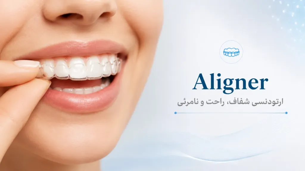 Aligner