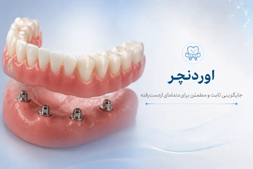 اوردنچر