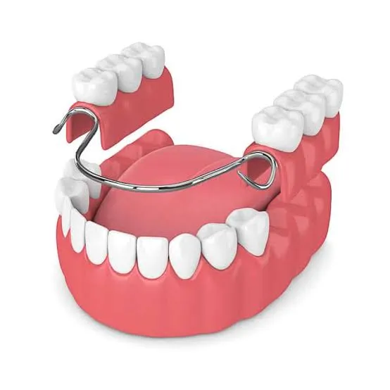 نمونه پروتز متحرک شماره 5