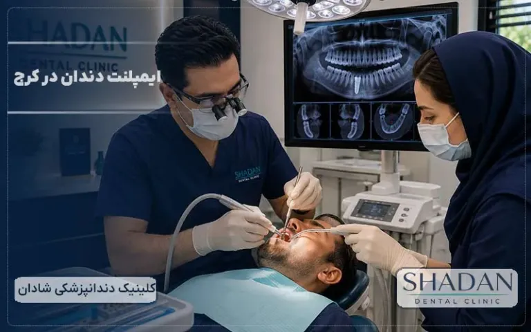 ایمپلنت دندان در کرج