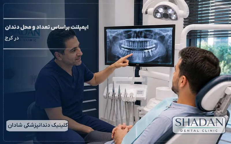 ایمپلنت براساس تعداد و محل دندان در کرج