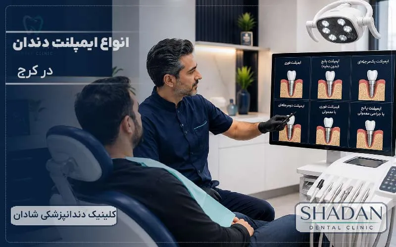 انواع ایمپلنت دندان در کرج