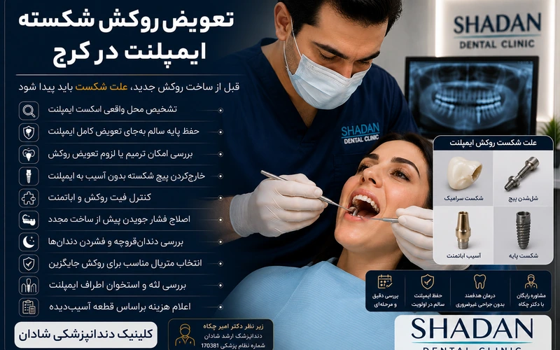 تعویض روکش شکسته ایمپلنت در کرج