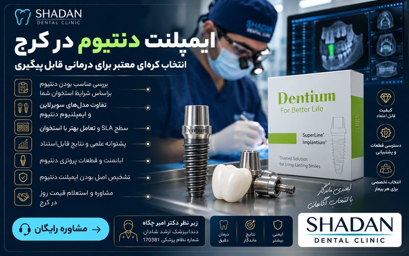 ایمپلنت دنتیوم در کرج