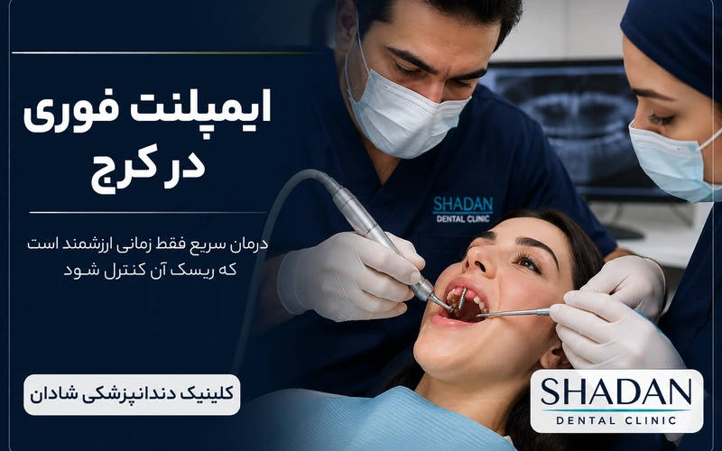 ایمپلنت یکمرحلهای در کرج
