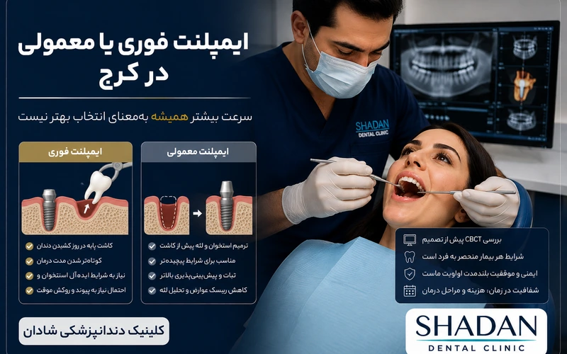ایمپلنت فوری یا معمولی در کرج
