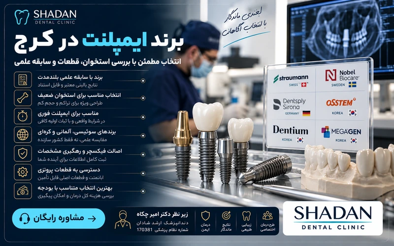 برند ایمپلنت در کرج