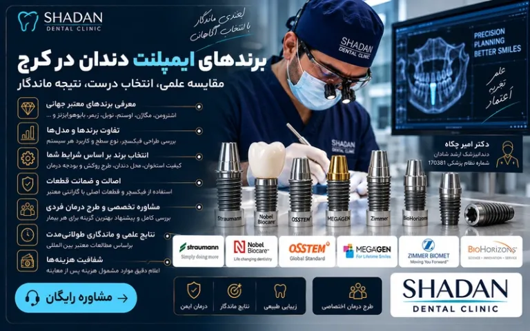 برندهای ایمپلنت دندان در کرج