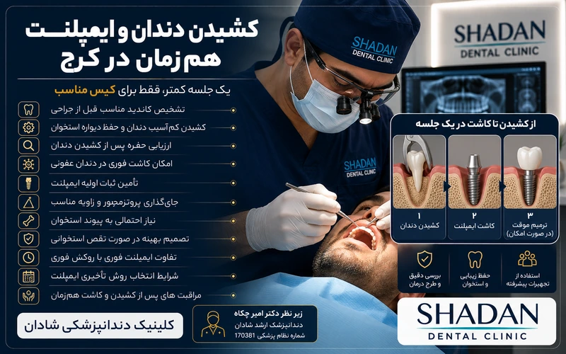 کشیدن دندان و ایمپلنت هم‌زمان در کرج