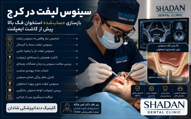 سینوس لیفت در کرج