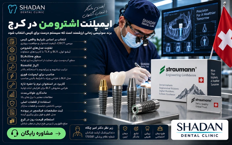 ایمپلنت اشترومن در کرج