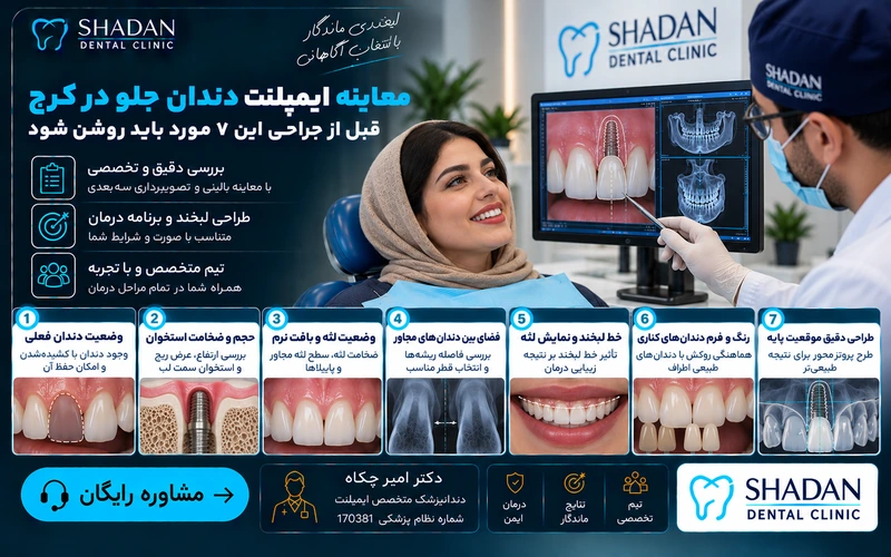 معاینه ایمپلنت دندان جلو در کرج