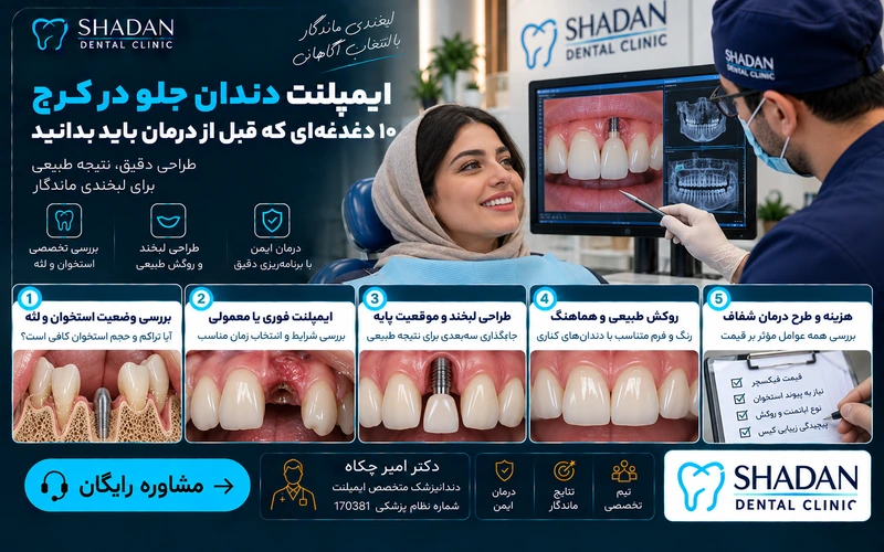 ایمپلنت دندان جلو در کرج