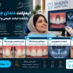 ایمپلنت دندان جلو در کرج