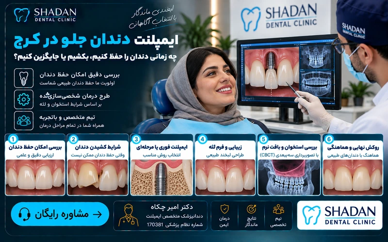 ایمپلنت دندان جلو در کرج؛ چه زمانی دندان را حفظ کنیم، بکشیم یا جایگزین کنیم؟