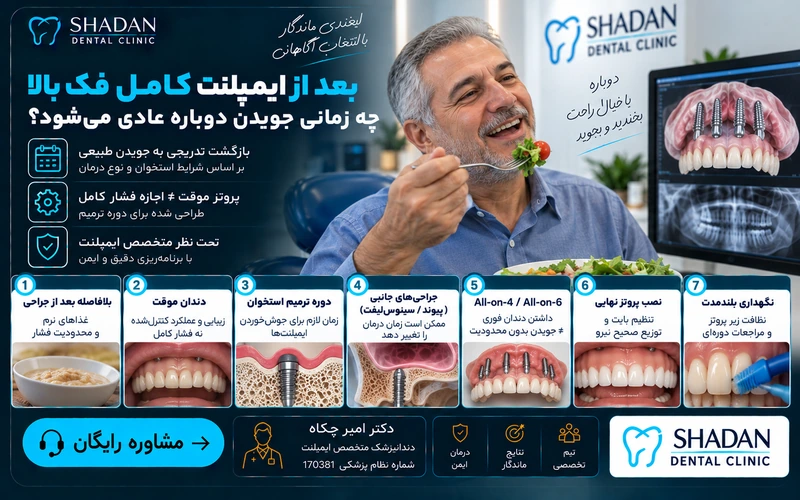 بعد از ایمپلنت کامل فک بالا چه زمانی جویدن دوباره عادی میشود؟