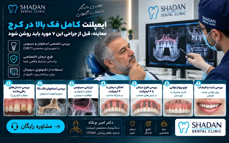 معاینه ایمپلنت کامل فک بالا در کرج