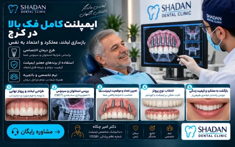 ایمپلنت کامل فک بالا در کرج