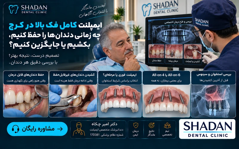 ایمپلنت کامل فک بالا در کرج