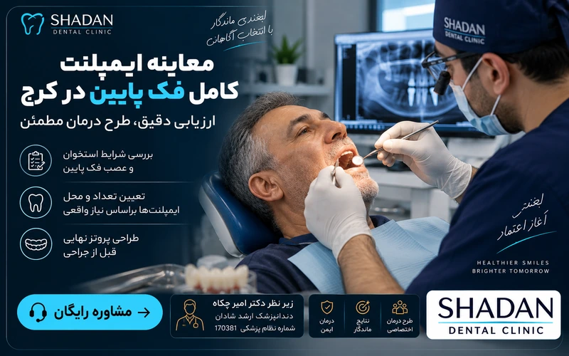 معاینه ایمپلنت کامل فک پایین در کرج