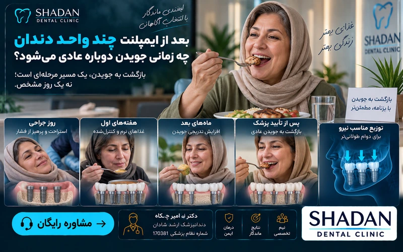 بعد از ایمپلنت چند واحد دندان چه زمانی جویدن دوباره عادی می‌شود؟