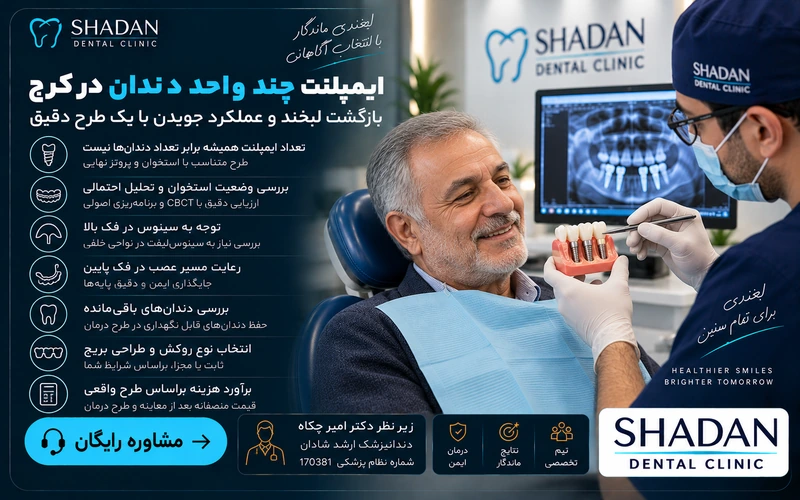 ایمپلنت چند واحد دندان در کرج
