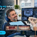 ایمپلنت چند واحد دندان در کرج 2