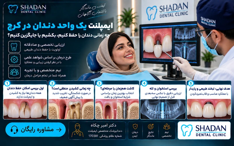 ایمپلنت یک واحد دندان در کرج؛ چه زمانی دندان را حفظ کنیم، بکشیم یا جایگزین کنیم؟
